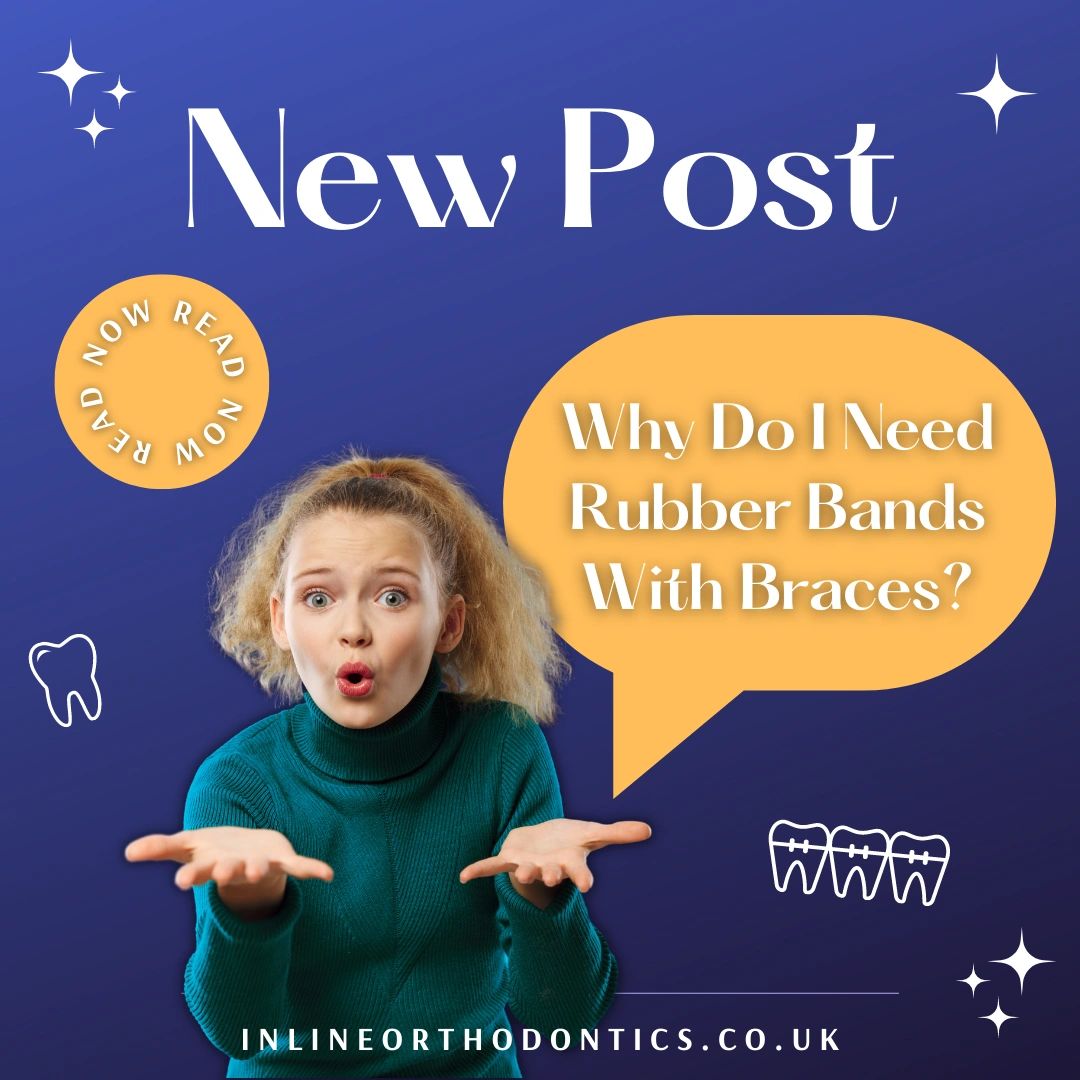 Why Do I Need Rubber Bands With Braces?